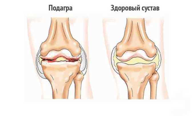 Цистон складу протипоказання і побічні дії