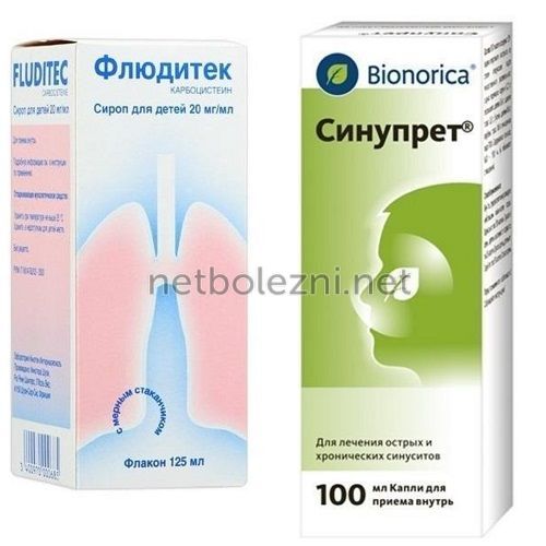 Риносинусит симптоми і лікування у дорослих