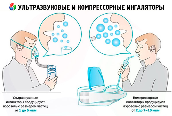 Розчини інгаляції при аденоїдах у дітей небулайзером