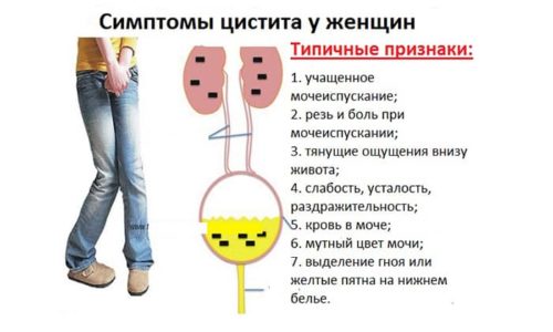 Які свічки призначаються при циститі