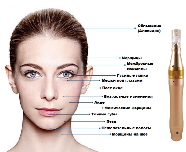 Дермапен і мезороллер для особи — безін’єкційна мезотерапія Mesoderm