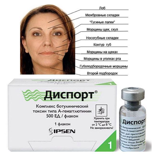 Диспорт — що це таке і застосування для підтяжки обличчя