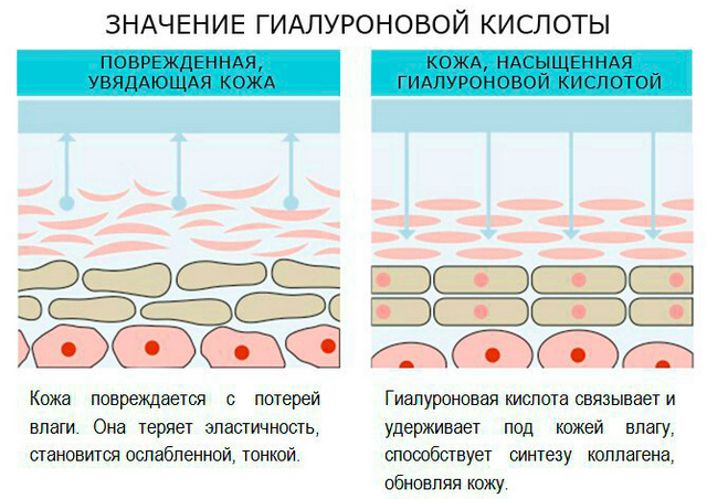 Гіалуронова кислота — властивості і застосування в косметології