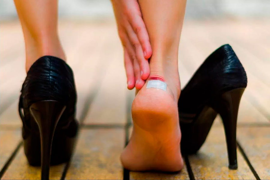 Кривава мозоль на шкірі – як вилікувати самостійно?