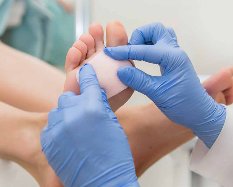 Кривава мозоль на шкірі – як вилікувати самостійно?