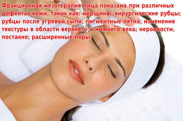Метод фракційної мезотерапії з фото до і після