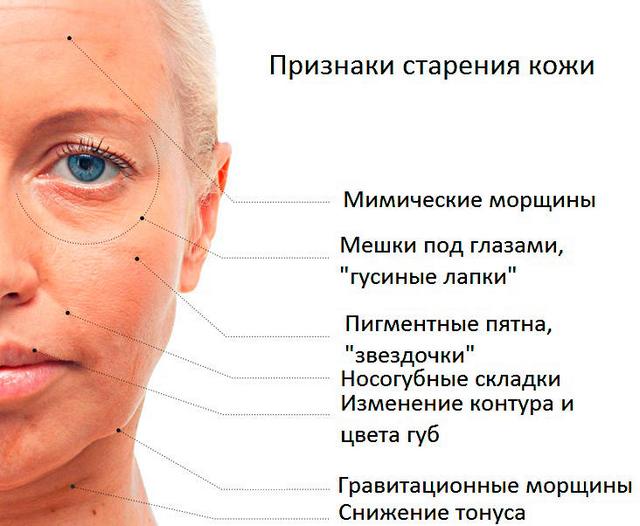 Методика і ефективність кругової підтяжки обличчя