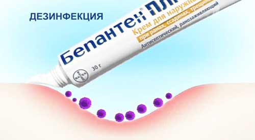 Найкращі засоби для відновлення шкіри після опіків