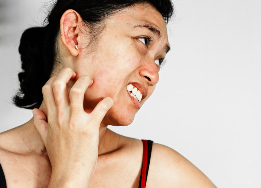 Названі небезпечні для шкіри алергени – уникайте їх