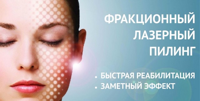 Омолодження обличчя методом лазерної шліфовки