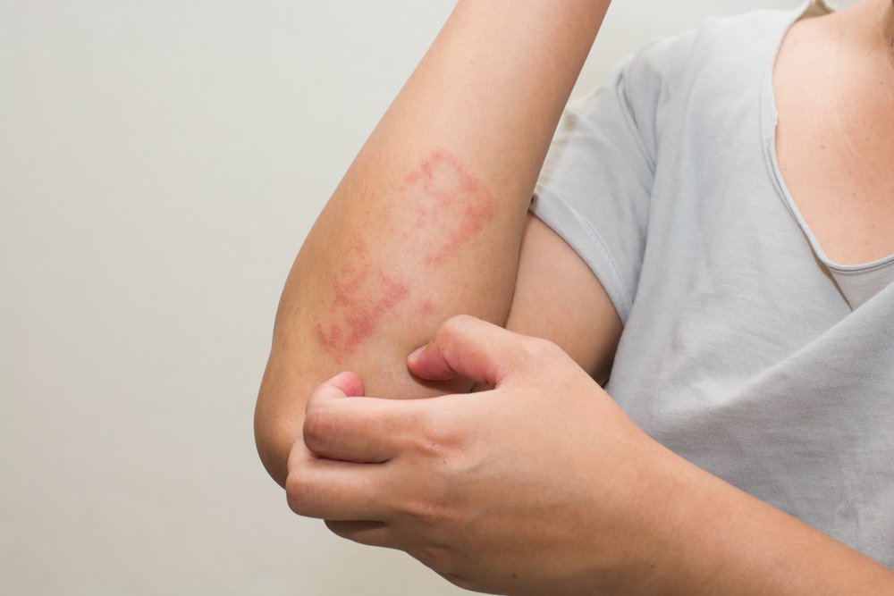Як захистити шкіру від захворювань? Профілактичні заходи