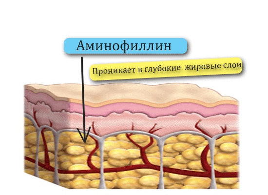 Застосування Аминофиллина від целюліту