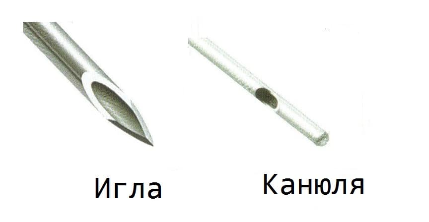 Збільшення губ гіалуроновою кислотою — все, що ви хотіли знати про процедуру
